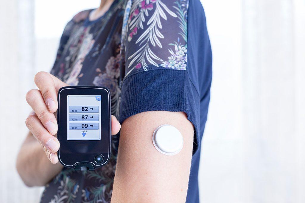 continuous glucose monitor