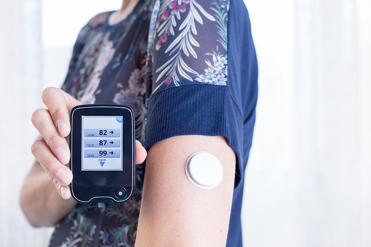 continuous glucose monitor