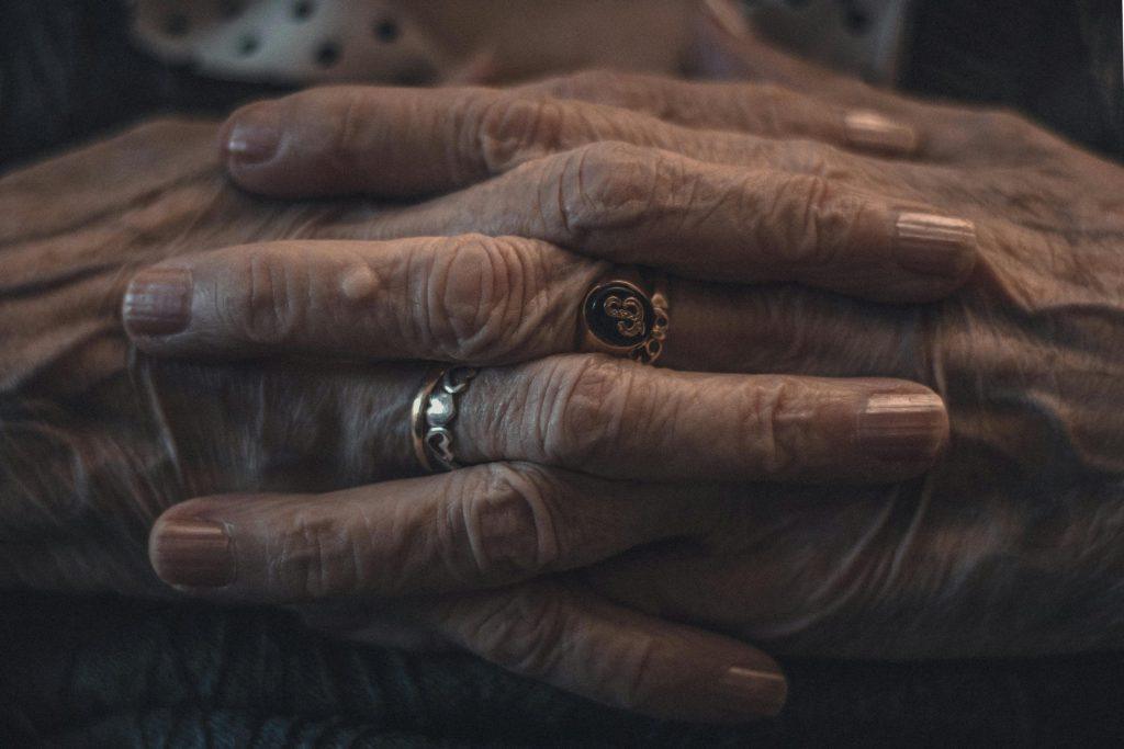 Person clasping hands that have arthritis